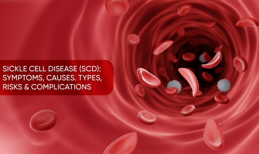 Understanding Sickle Cell Disease: Symptoms, Causes, and Diagnosis